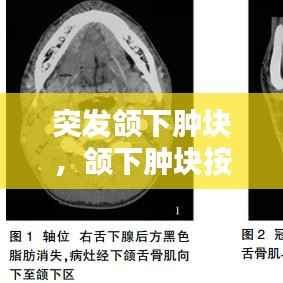 突发颌下肿块，颌下肿块按压疼 
